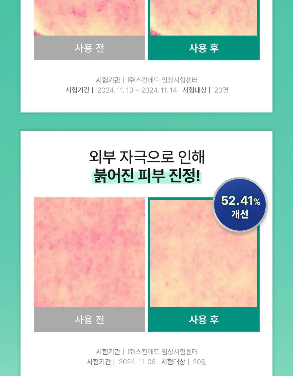[민감피부진정/쿨링수분크림] 셀퓨전씨 포스트 알파 시카 카밍 다운 크림 50ml 기획 (+50ml 리필) 상세페이지 12